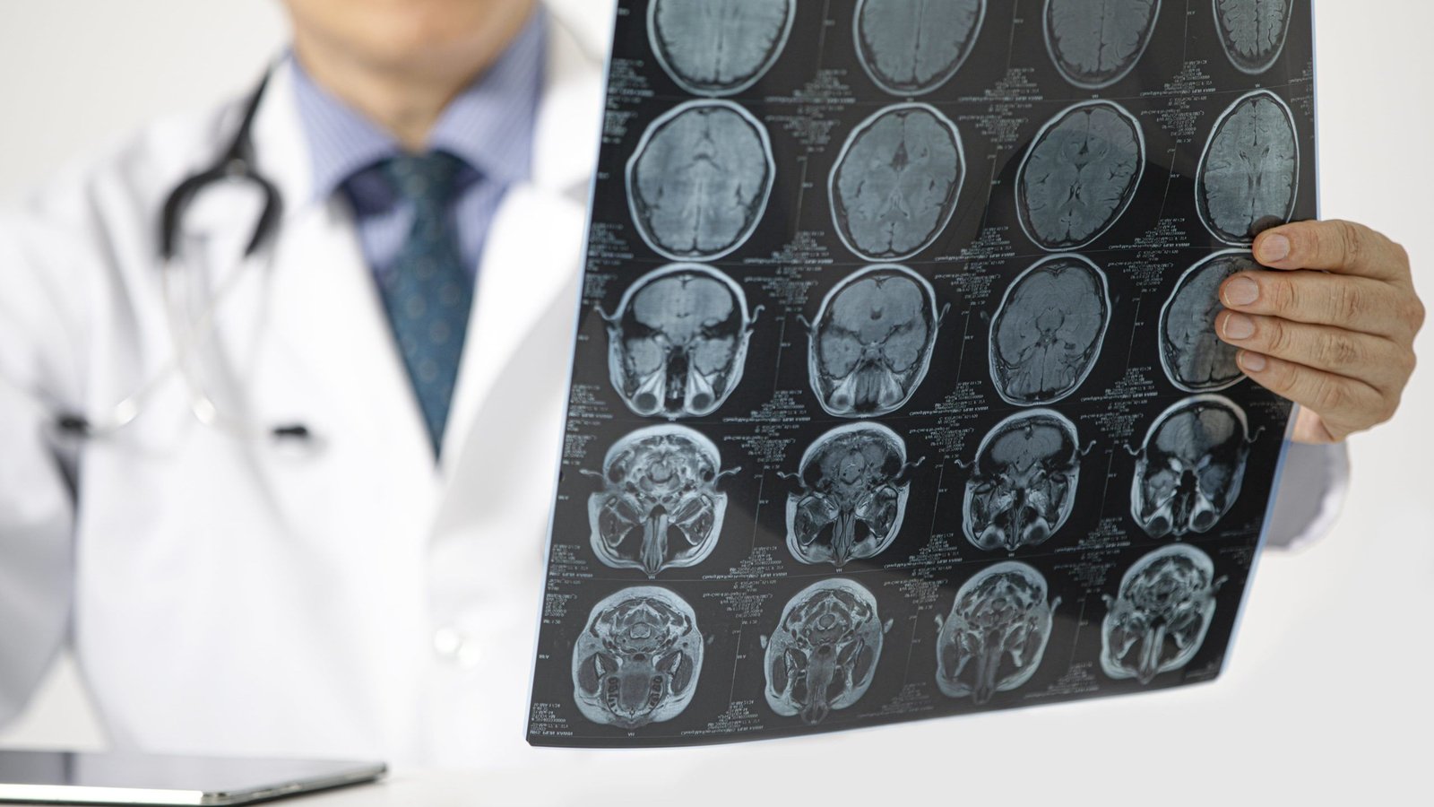 Fotografia de médico analisando Ressonância Magnética